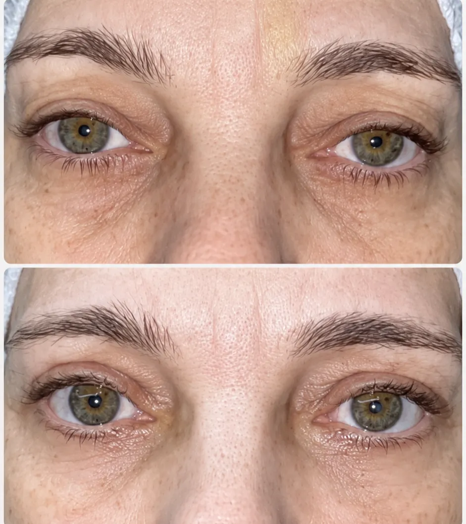 antes-e-depois-2.webp