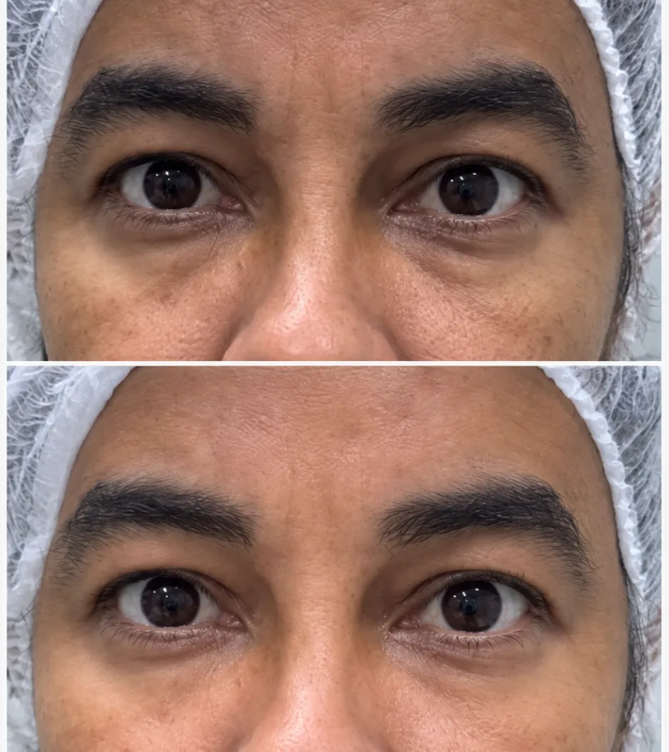 antes-e-depois-5.webp