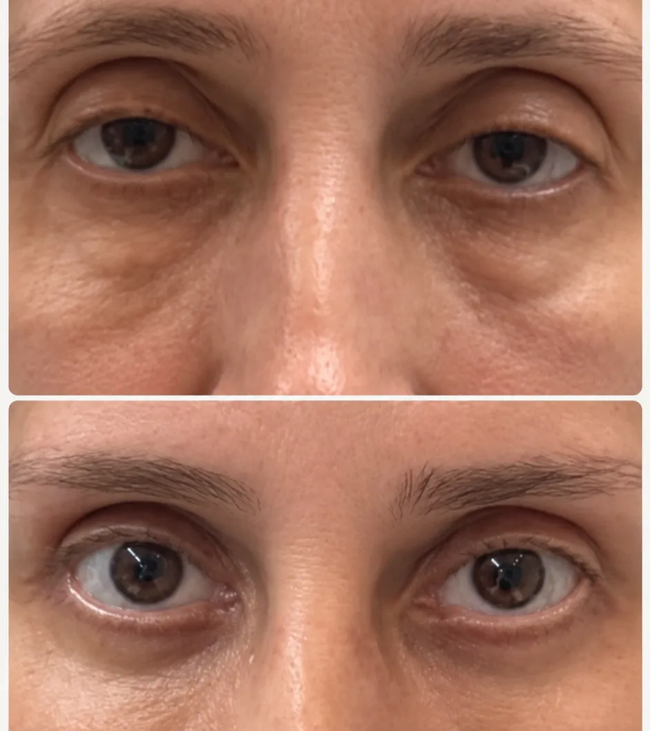 antes-e-depois.webp